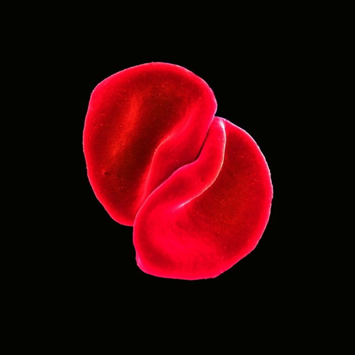 Peter Gabriel - Scratch My Back